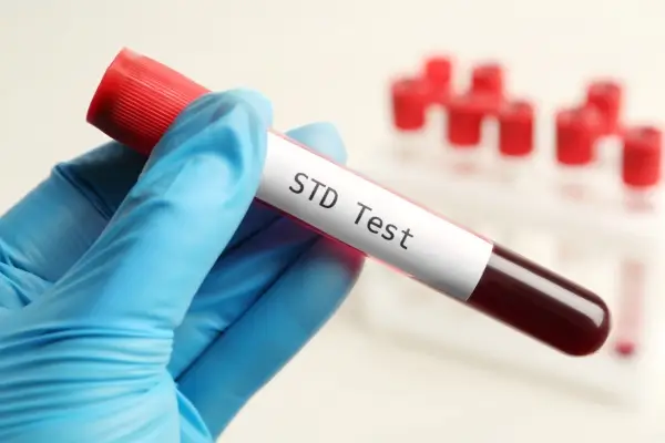 STD Testing and Treatment