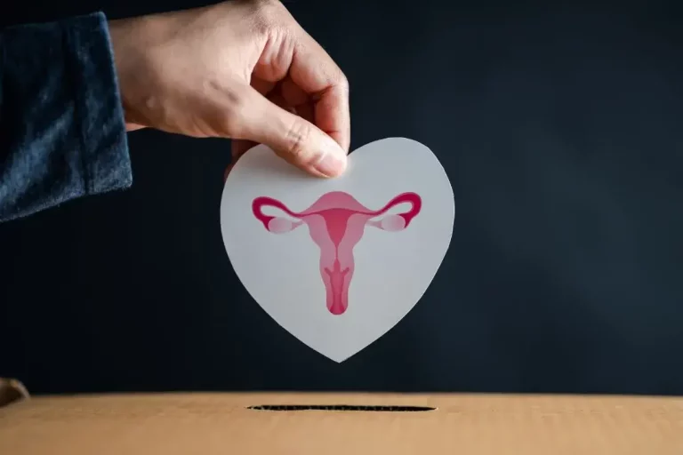 What is PCOS Meaning in Urdu?