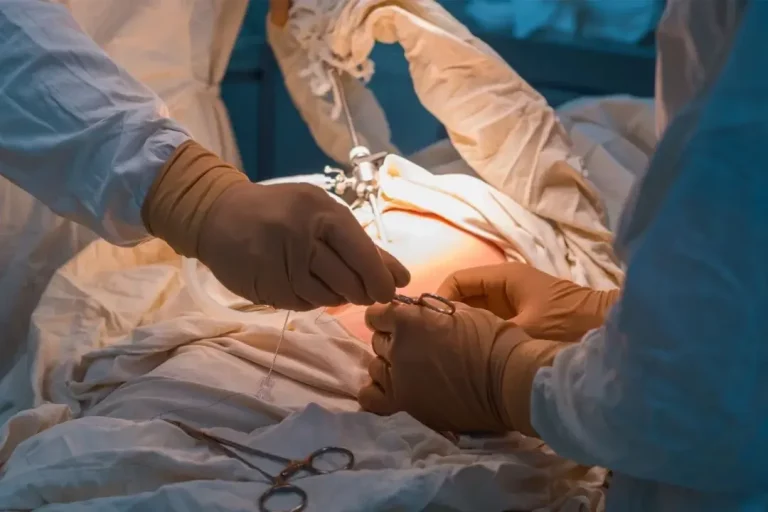 laparoscopic gynecological surgery