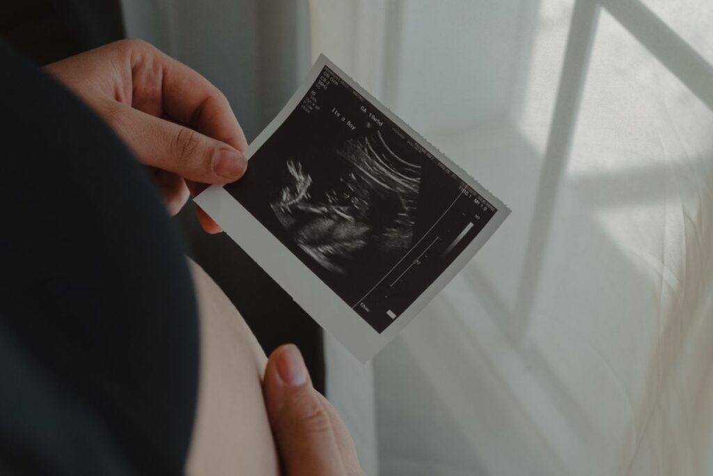 Ultrasound Scans and What to Expect in Each Trimesters Stage